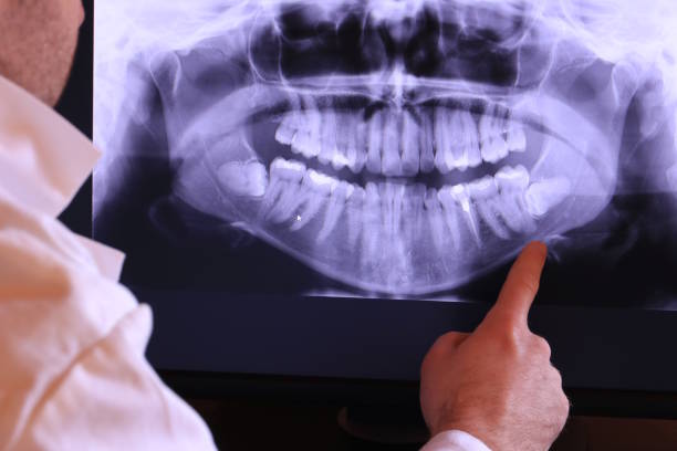Best Cracked Tooth Emergency Dentist  in Hebron, IN